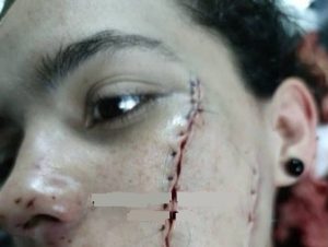 La mujer tuvo varias cortadas en la cara