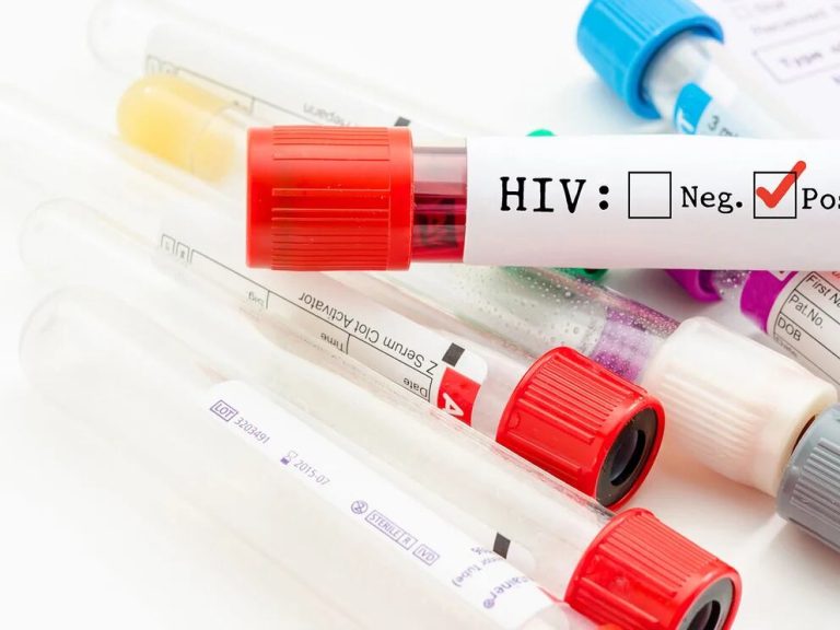 Investigadores encuentran un tratamiento que podría eliminar el VIH del organismo