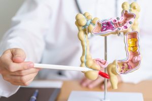 Los médicos defienden la importancia de comer sanop para evitar esta enfermedad